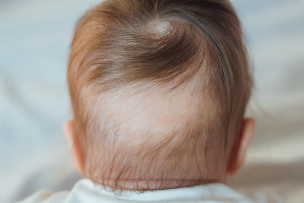 Pérdida de cabello en el bebé: una guía para los nuevos padres